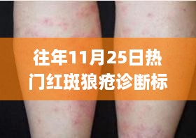 红斑狼疮诊断标准详解及最新诊断步骤探讨，历年热点解析与实际应用指南（往年11月25日热点更新）