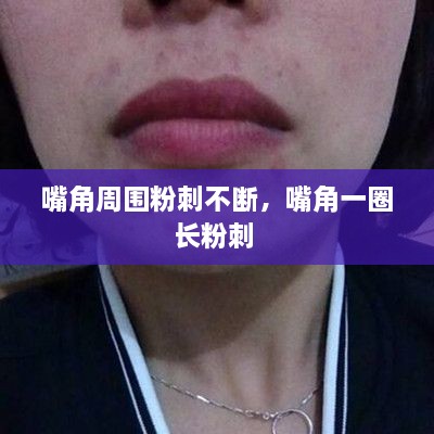 嘴角周围粉刺不断，嘴角一圈长粉刺 