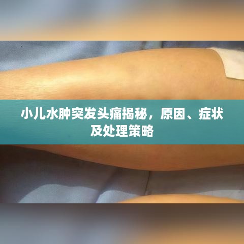 小儿水肿突发头痛揭秘，原因、症状及处理策略